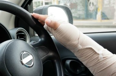 Dirigir com Braço Engessado dá Multa? Descubra agora