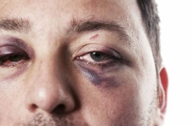Agressão a Agente Público – Veja O Que a Lei Prevê
